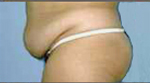 Bauch weg gurtel nach geburt