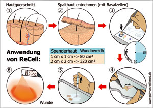 ReCell - Haut zum Sprühen