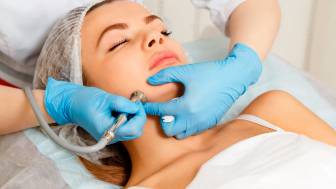 Dermabrasion