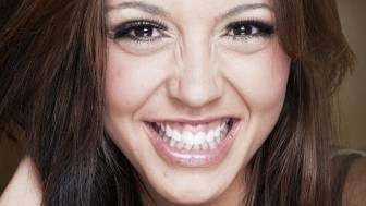 Was bedeutet "gummy smile" und wie kann es mit Botulinumtoxin behandelt werden?
