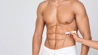 High-definition Liposuction