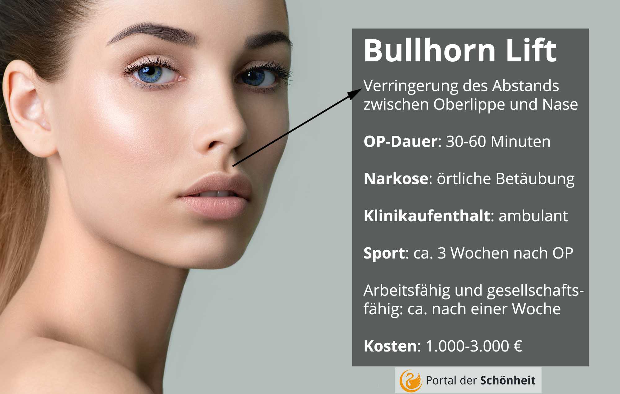 Bullhorn-Lift (Lip Lift) » Kleiner Eingriff, volle Lippen