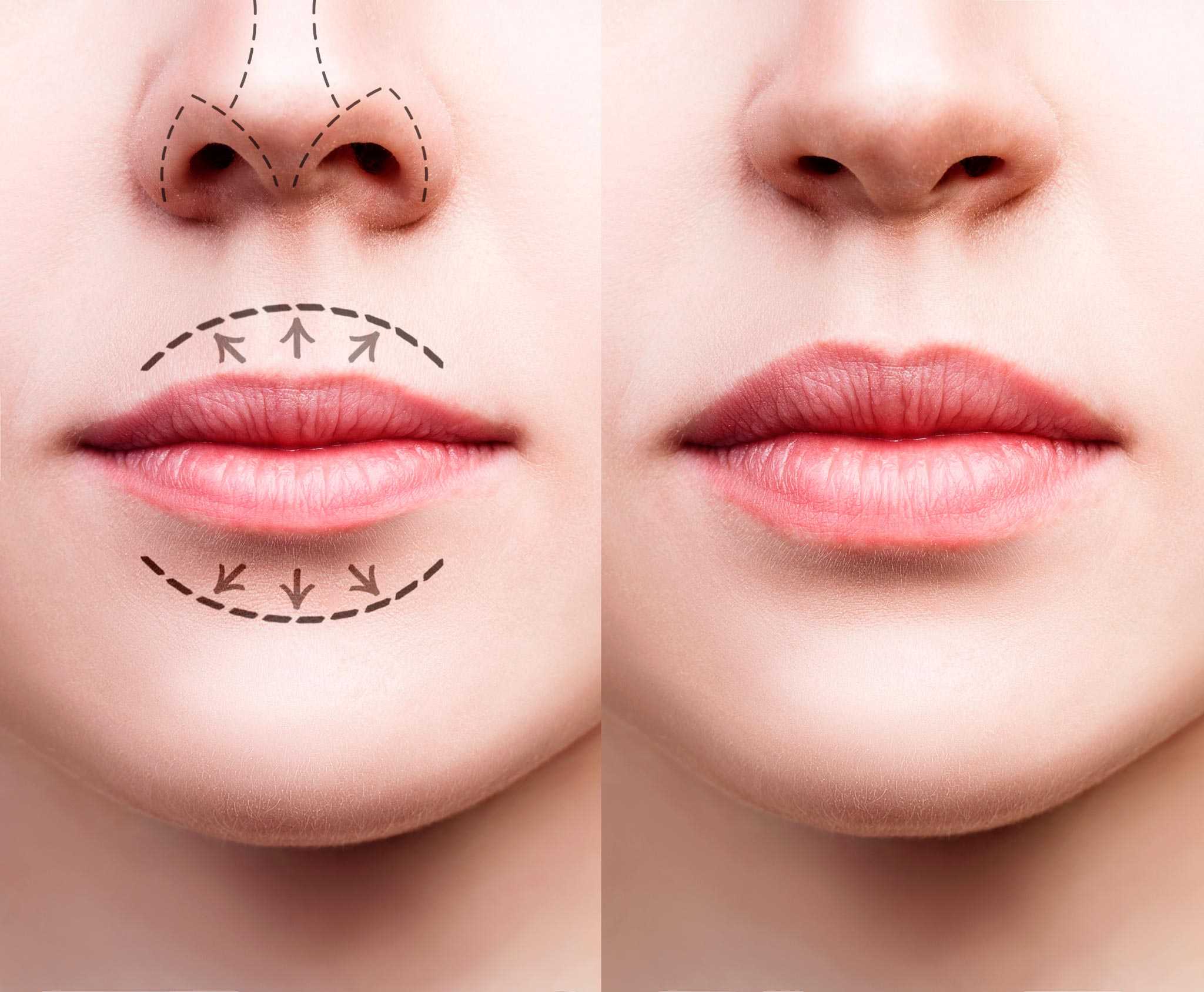 Lippen männer schmale Große oder