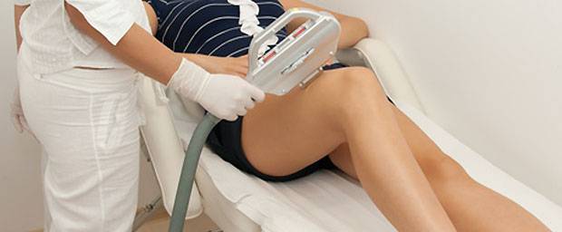 haarentfernung mit einem laser