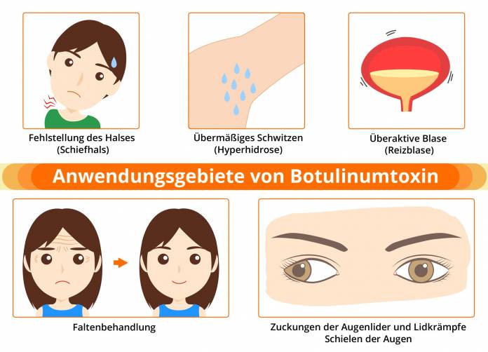 Anwendungsgebiete von Botulinumtoxin