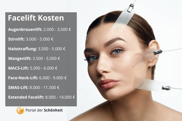 Facelift Kosten