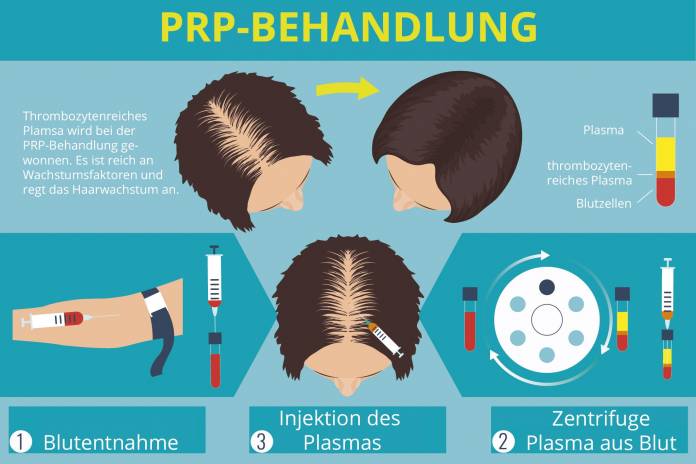 PRP-Behandlung